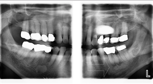 More detailed dental xray