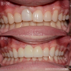 Smile Gallery Case 8 Before and After Photo
