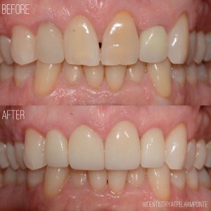 Smile Gallery Case 7 Before and After Photo