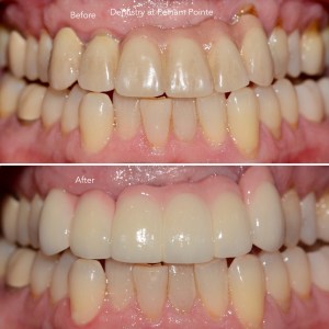 Before & After Smile Gallery